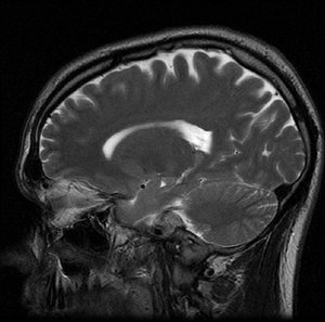 Brain CT scan