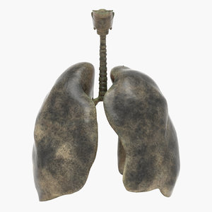 3D model smoker lungs