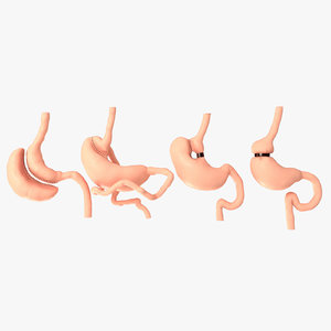 stomach surgery 3D