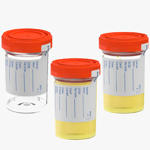 3D urinari sample cups