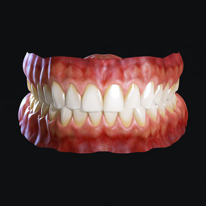 3D model human teeth