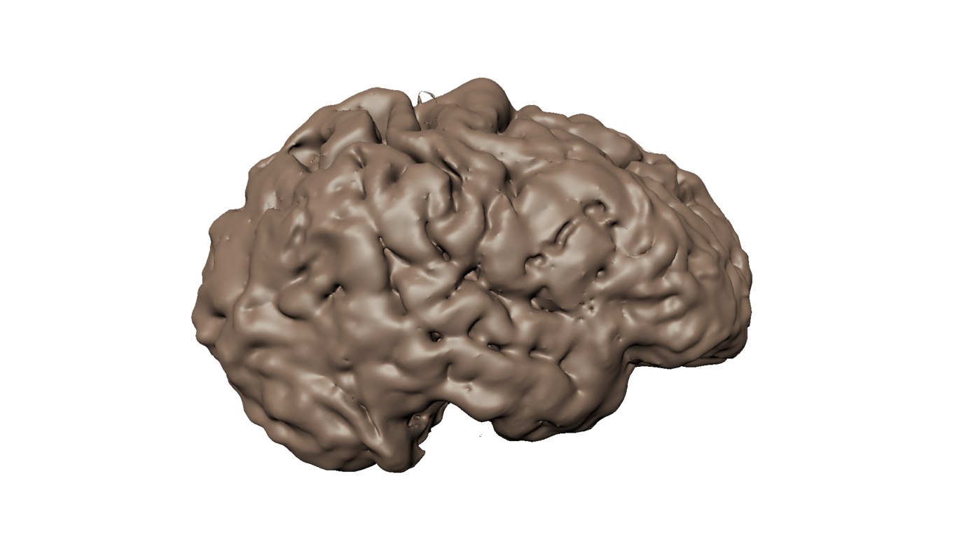 Ct Scan Human Brain 3d Model Turbosquid 1381342