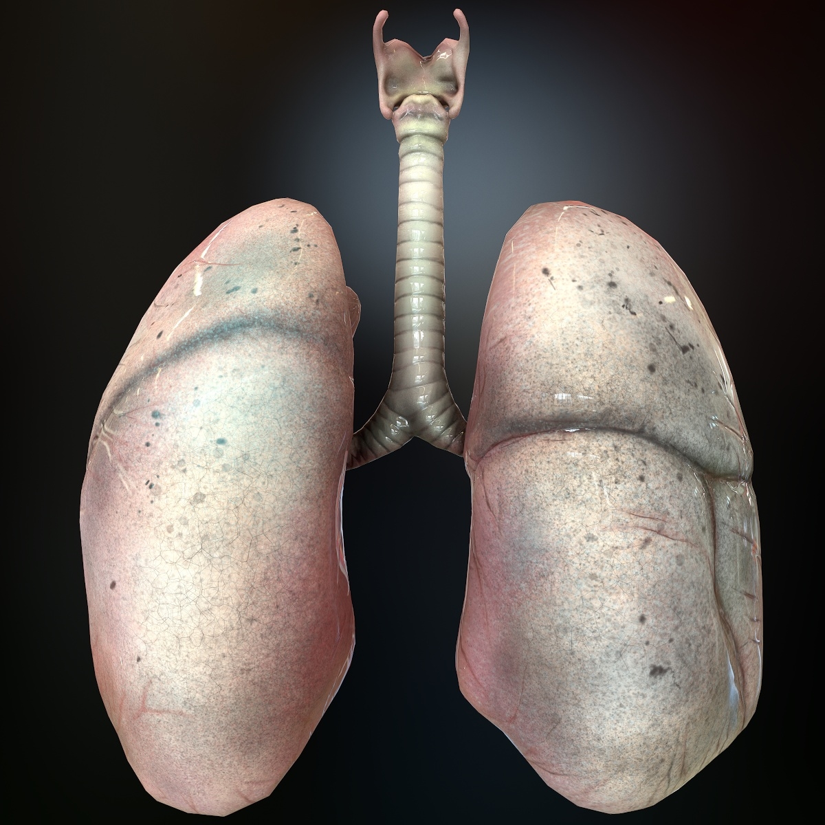 总部人肺3d模型