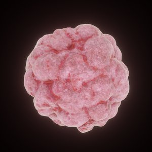 3D cancer cell model
