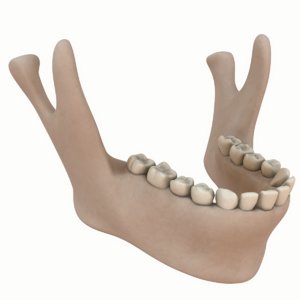 lower jaw mandible underhung 3D model