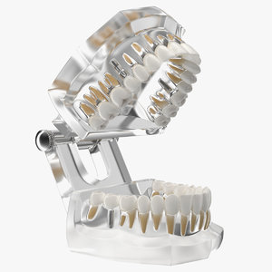 3D transparent dental typodont implants