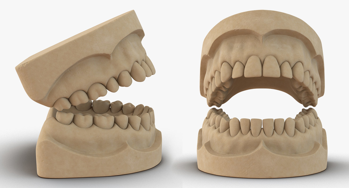 牙科收藏43d模型