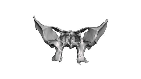 sphenoid bone图片