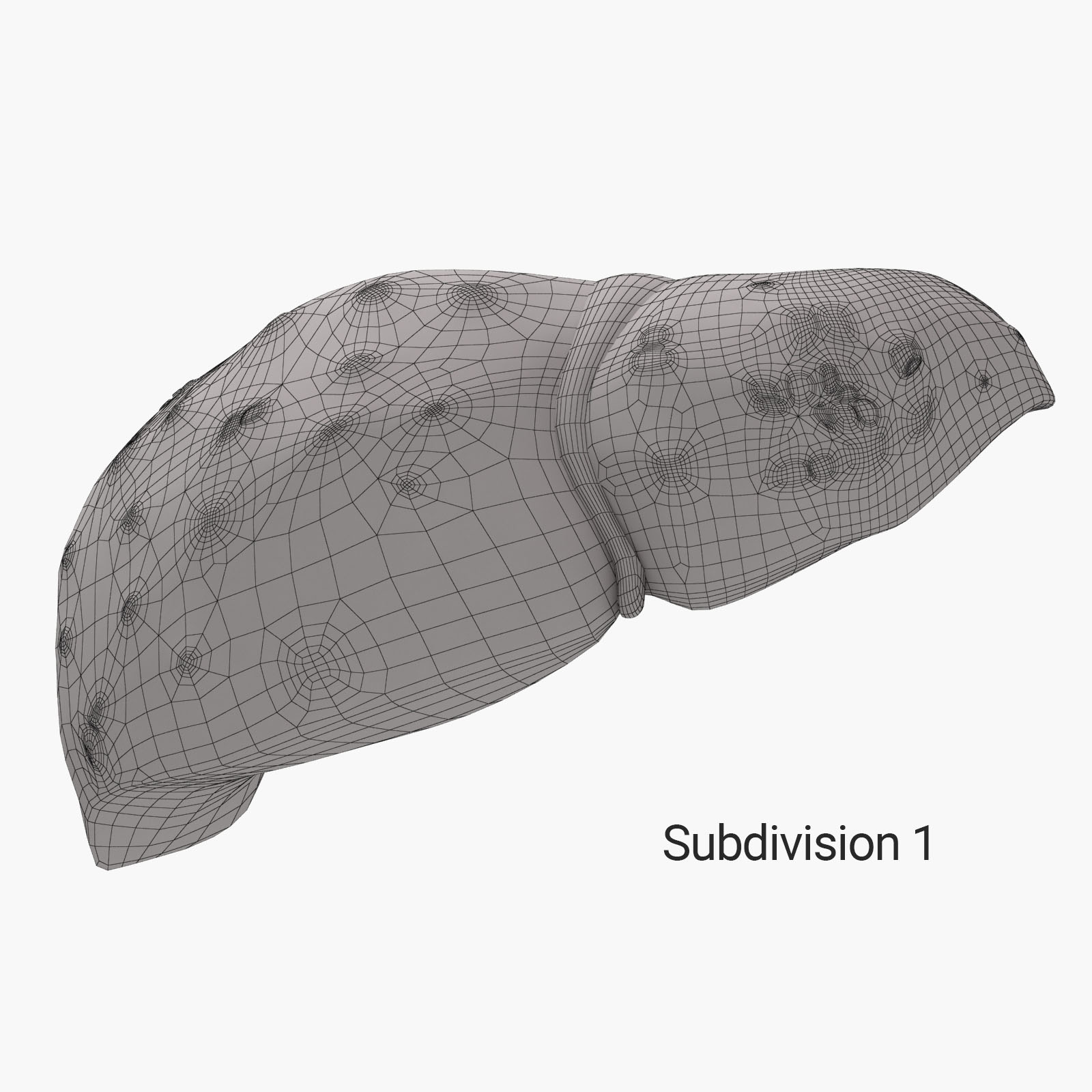 3d liver cirrhosis