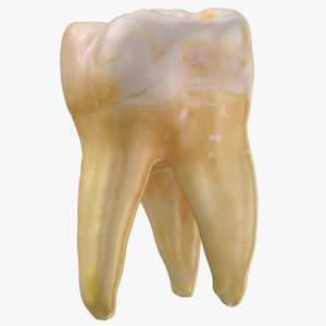 molar upper jaw right 3D model