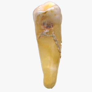 3D premolar lower jaw 04