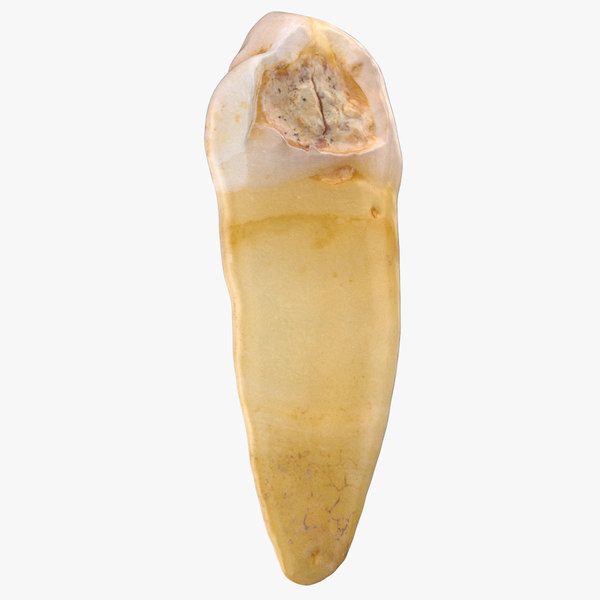 3D model molar jaw - TurboSquid 1509063