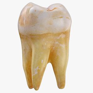 molar upper jaw right 3D