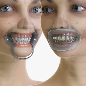 primary dentition mannequin 3D model