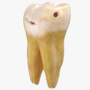 molar lower jaw left model