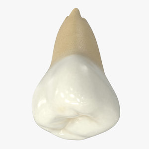 human wisdom teeth upper 3D