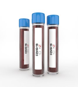 3D coronavirus blood sample model