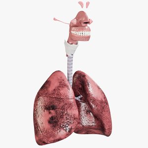 respiratory smoker s lungs 3D model