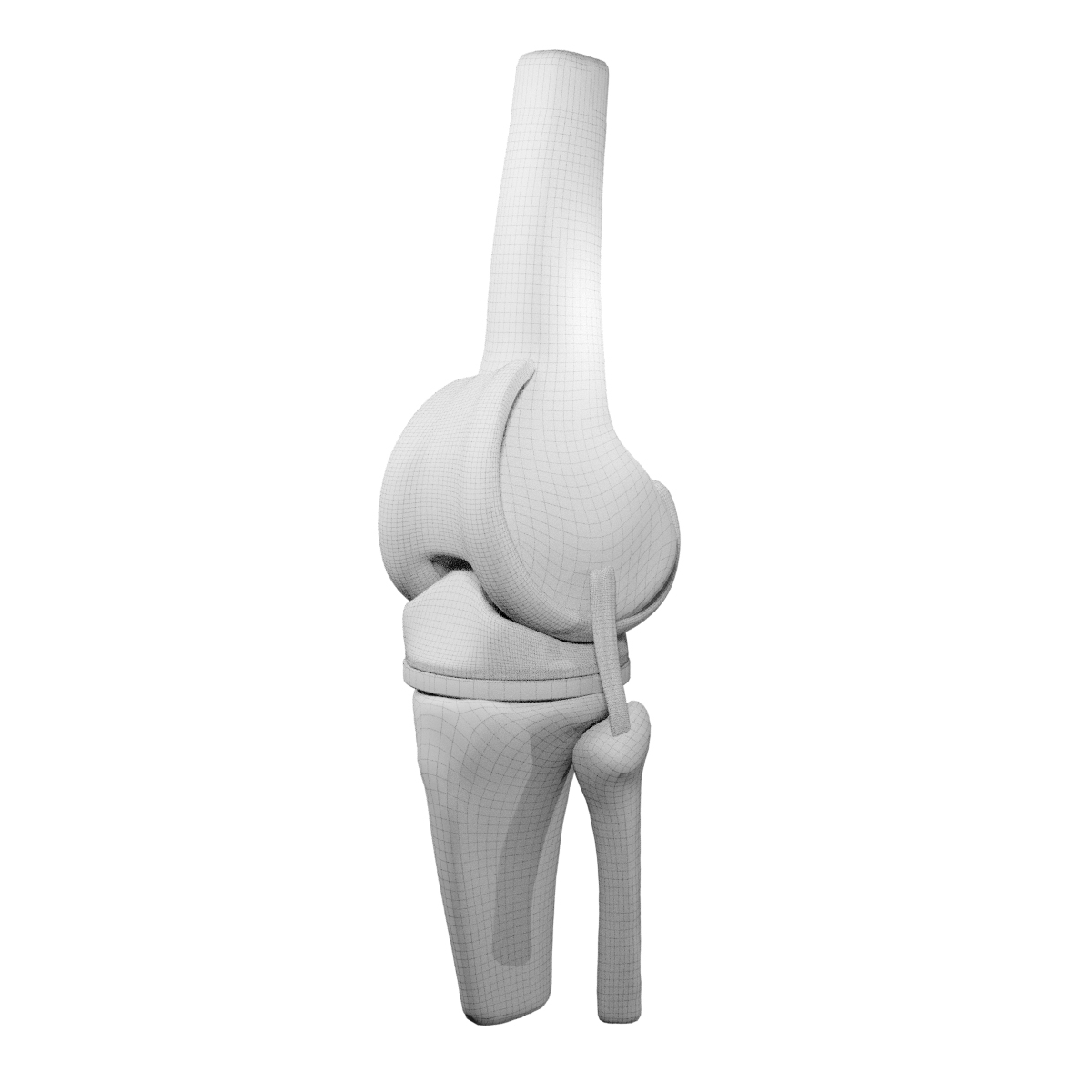 3D knee replacement model TurboSquid 1520233