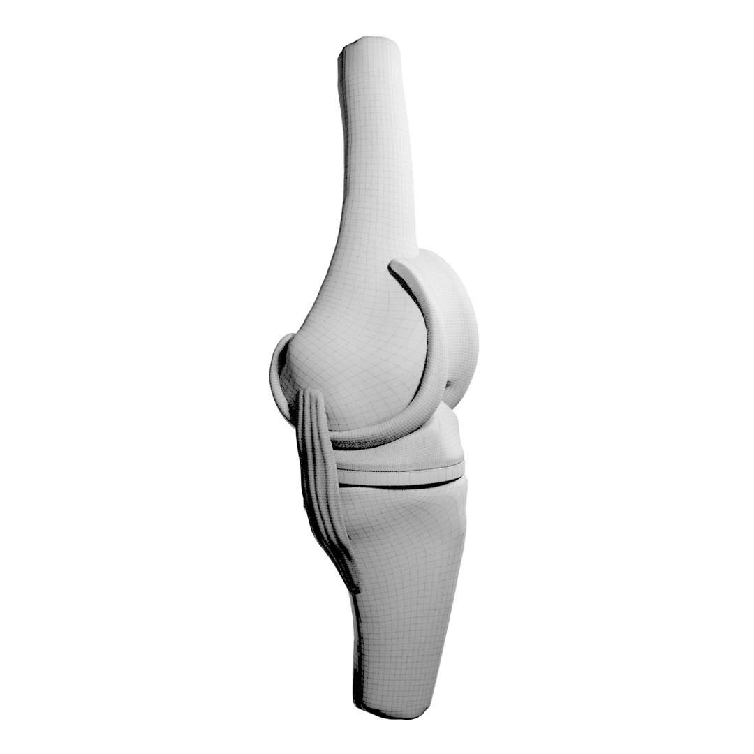 3D knee replacement model TurboSquid 1520233