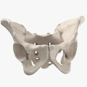 3D human pelvis damaged sacrum model