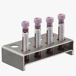 3D coronavirus blood samples 02 model