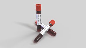 test tube blood coronavirus model