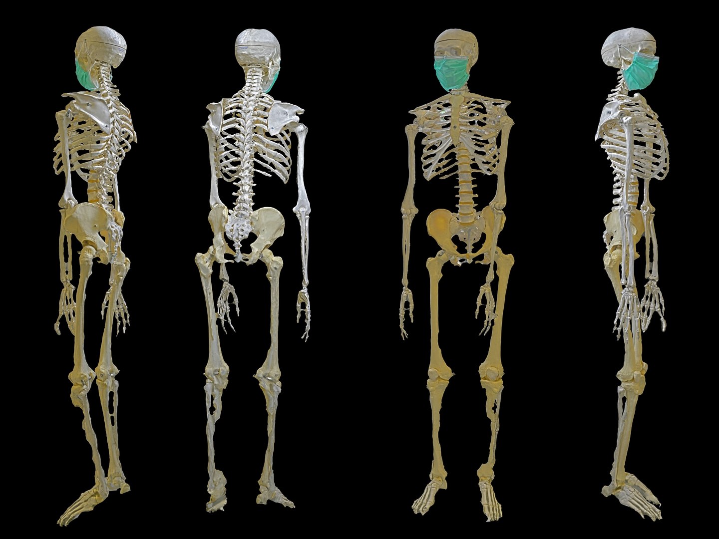 3D real human skull model - TurboSquid 1573691