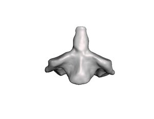 3D surgeries neck anatomy