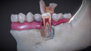 tooth mandible model