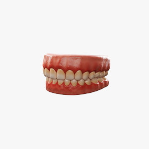 dental prosthesis modelling 3D model